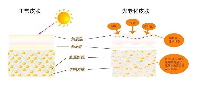光老化与糖化双危机，破解皮肤加速衰老的防护密码
